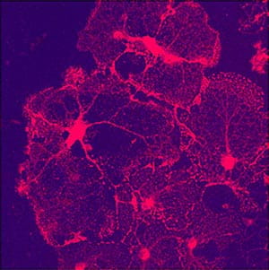 Oligodendrocytes generated from progenitor cells.